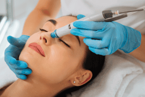 dermapen z maska